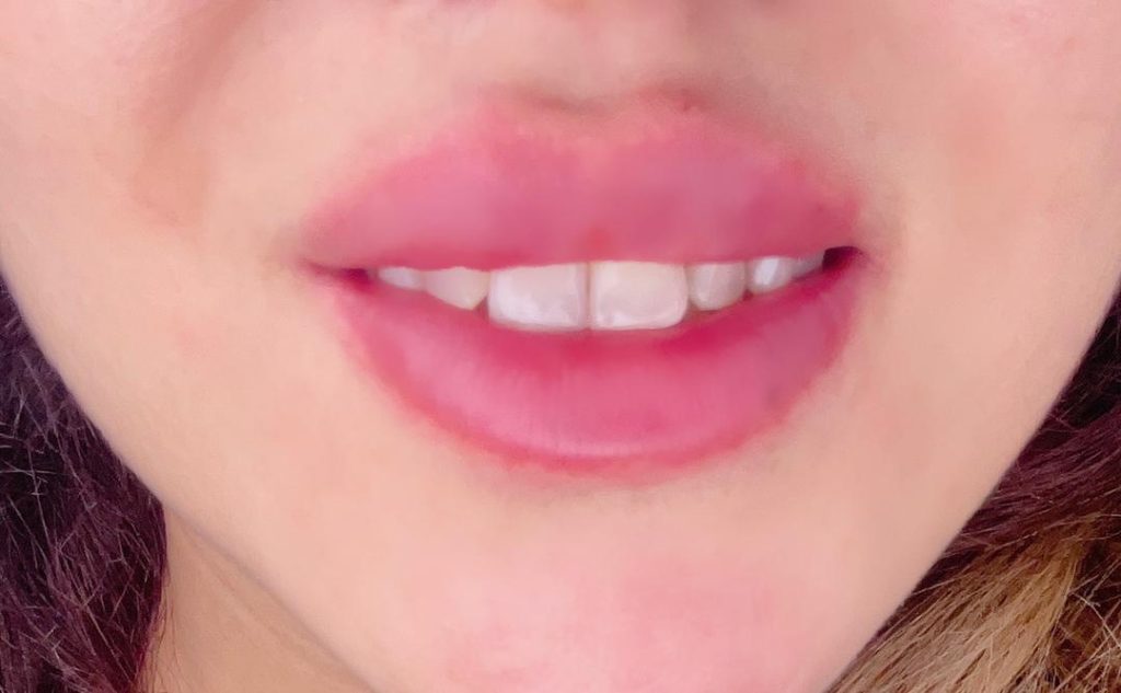 انواع خدمات زیبایی